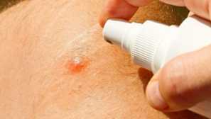 Хапка на оса и неговите последици: как могат да атакуват os